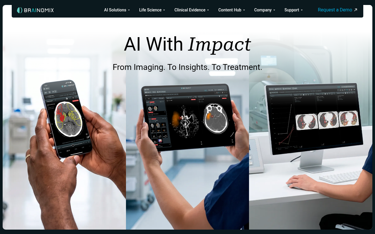 Brainomix product interface