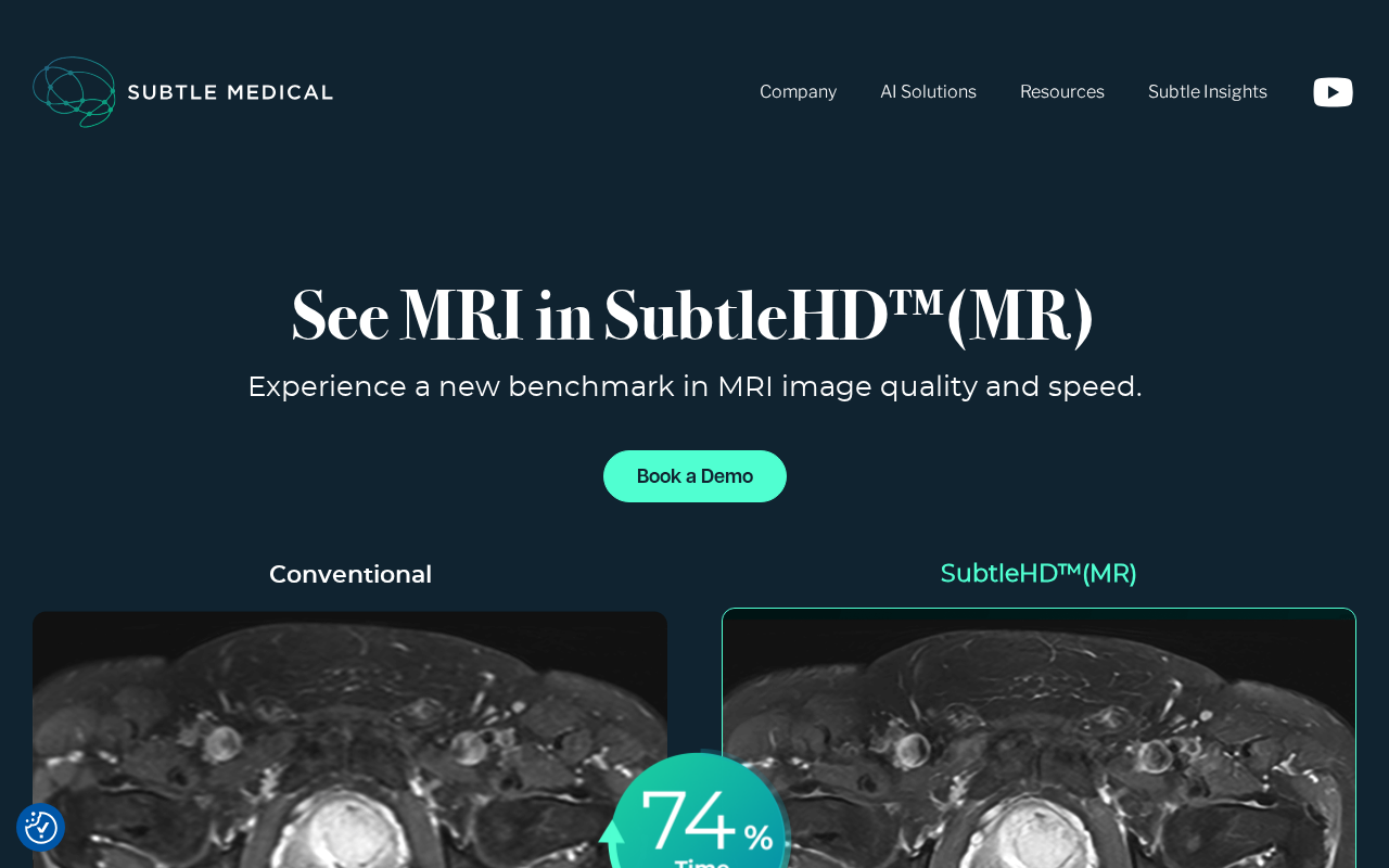 Subtle Medical product interface